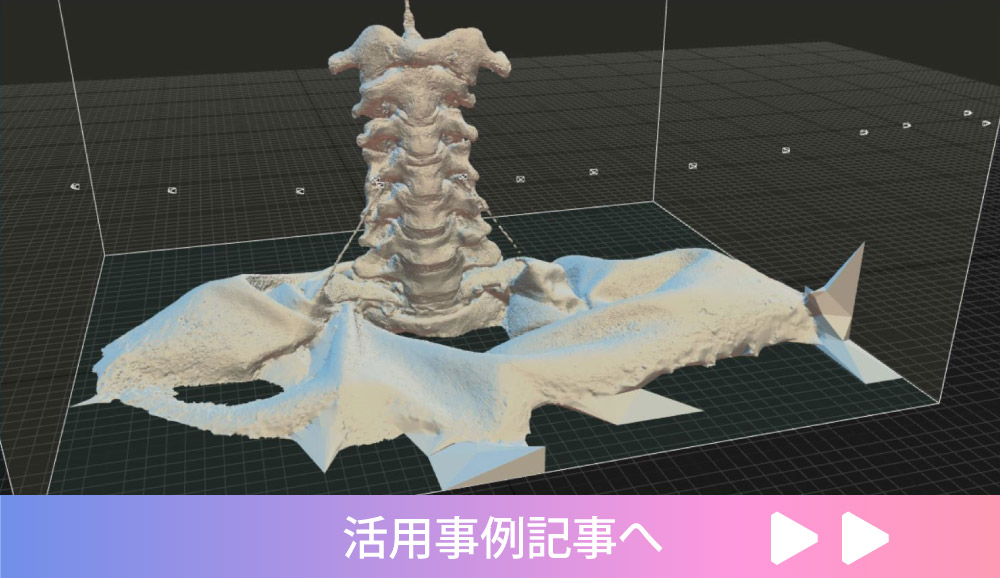 バーチャル頸椎の3D活用事例